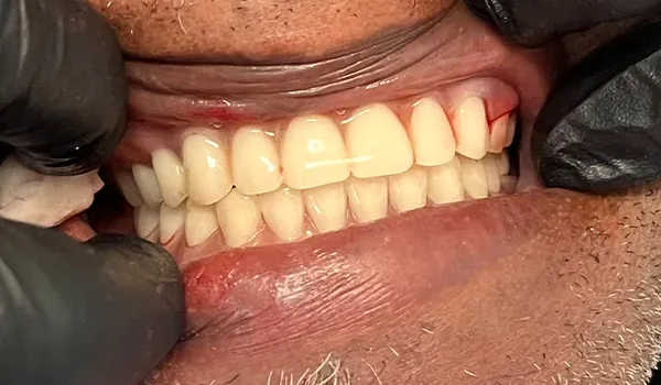 After image