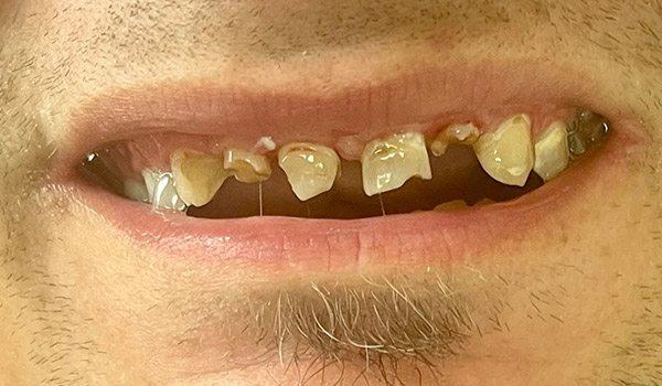 Before image
