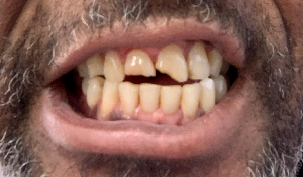 Before image