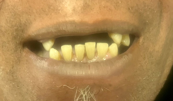Before image